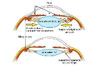 با این روش ها بازسازی طبیعی بینایی حتی در سنین بالا ممکن است!