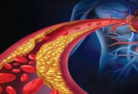 کاهش چشمگیر سکته‌های قلبی و مغزی با مصرف مستمر قرص پلی‌پیل