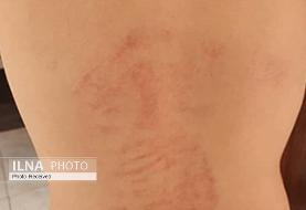 دوباره تنبیه بدنی دانش‌آموز؛ اینبار معلم ورزش + عکس