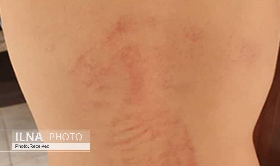دوباره تنبیه بدنی دانش‌آموز؛ اینبار معلم ورزش + عکس