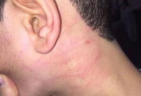 موضوع «ضرب و شتم دانش آموز در یکی از مدارس آذربایجان شرقی» پیگیری می‌شود