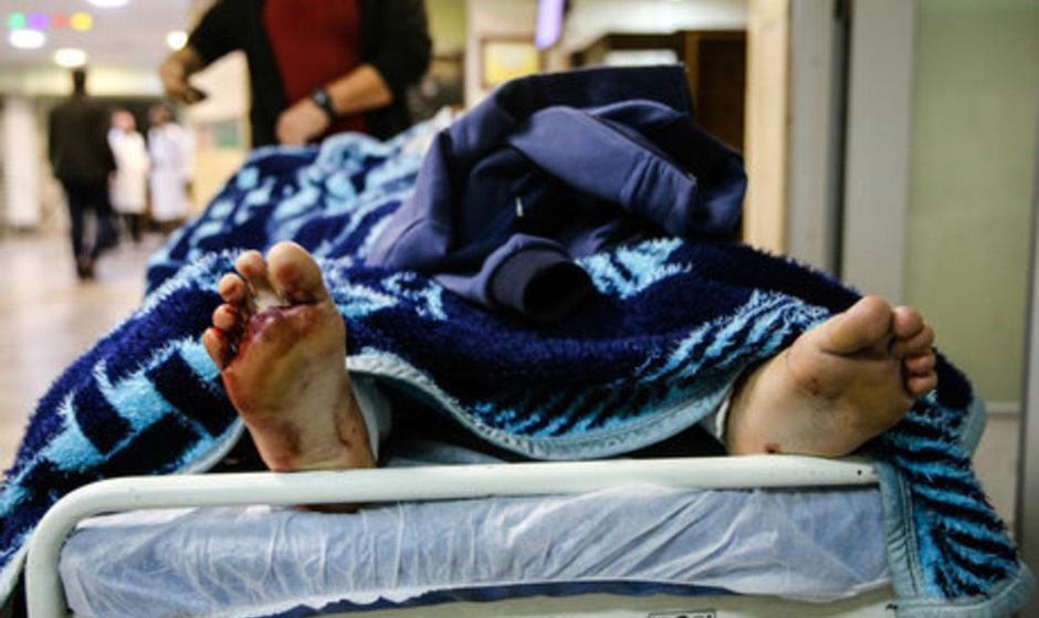 آمار سوختگی سالانه در ایران/ افراد فقیر بیشتر دچار سوختگی می‌شوند