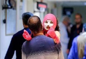 اولین حادثه چهارشنبه‌سوری رقم خورد | آخرین وضعیت مصدومیت دو کودک ۱۰ و ۱۱ ساله