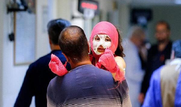 اولین حادثه چهارشنبه‌سوری رقم خورد | آخرین وضعیت مصدومیت دو کودک ۱۰ و ...