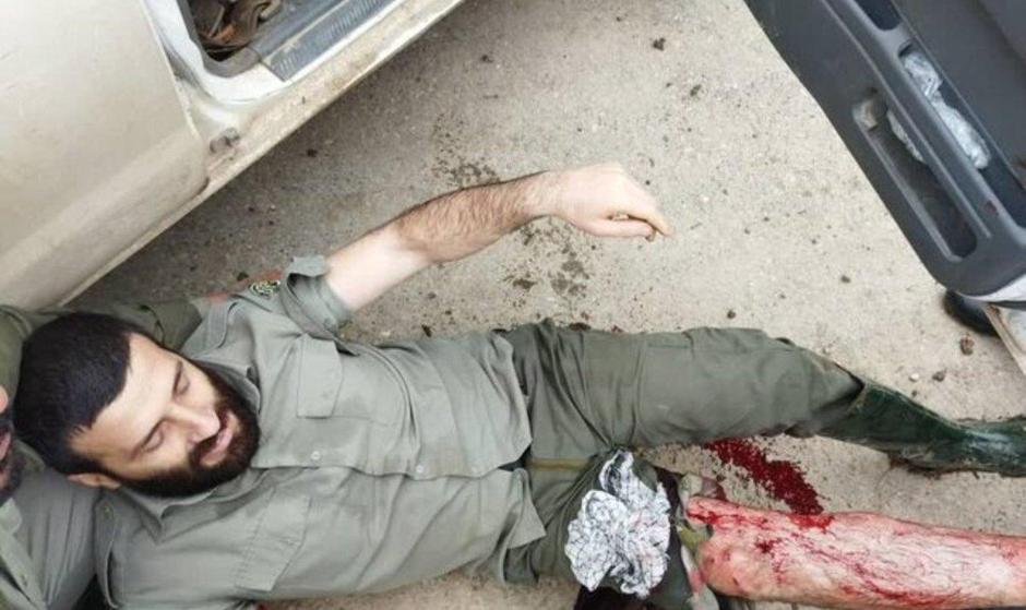 ضارب محیط‌بان مجروح پارک ملی 