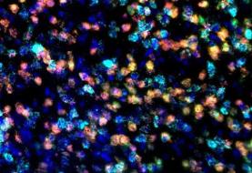 کنترل فعالیت مغز با میدان‌های مغناطیسی