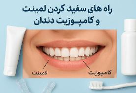 راه های ترمیم و سفید کردن لمینت و کامپوزیت دندان