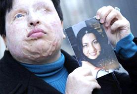 آمنه بهرامی دوباره پیگیر حقش شد