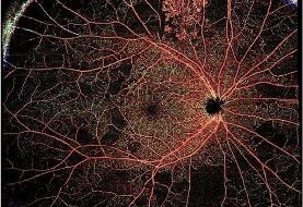 چشم‌ها دریچه‌ای به سلامت قلب هستند