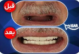 اپل بالاخره سیری را متحول میکند؛ دستیار هوشمند آیفون سال آینده از نو متولد میشود