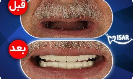 یک فوتی و ۳ مصدوم در آتش‌سوزی واحد پالایش نفت در ایوانکی