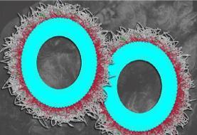 نابودی بیش از ۸۰ درصدی تومورهای تخمدان با نانوذرات جدید