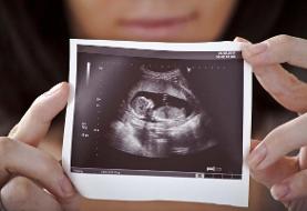 توضیح دبیر ستاد ملی جمعیت درباره غربالگری در دوران بارداری