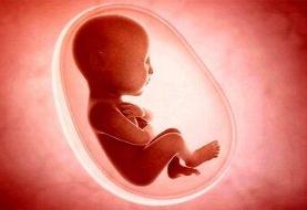 ۸۰ درصد شاکیان سقط جنین مردها هستند/ مواردی که قاضی اجازه سقط جنین قانونی نمی‌دهد