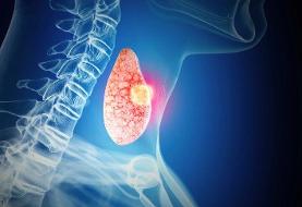 سرطان‌ تیروئید: یک بیماری علاج‌پذیر