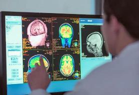 مغزتان تا ۳۰ سالگی هم می‌تواند نوجوان باشد!