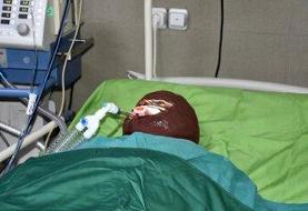 اسیدپاشی هولناک روی پدر و دختر