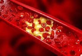 راهی ساده برای کاهش چربی خون که از آن غافلیم