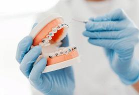 چرا انتخاب یک متخصص ارتودنسی خوب همه چیز را تغییر می دهد؟