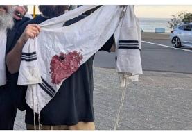 واکنش‌های بین‌المللی به حادثه استرالیا؛ از استارمر تا رئیس کمیسیون اروپا