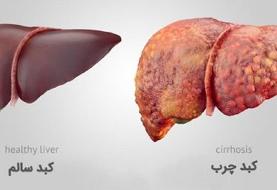 راهکارهای تغذیه‌ای برای درمان کبد چرب (اینفوگرافیک)