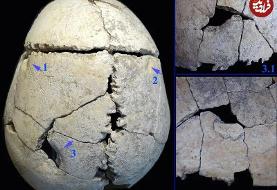 فرو رفتن دندان شیر در جمجمه یک نوجوان + عکس | اسکلت ۶ هزار سال قبل را ببینید