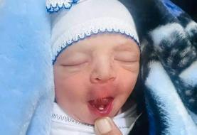 تولد یک نوزاد با دندان/ عکس