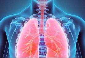 چه کسانی بیشتر در برابر آلودگی هوا آسیب‌پذیرتر هستند؟