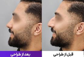 جراحی بینی در تهران با پزشک ۲۴