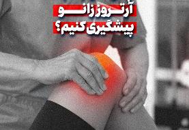 چگونه از ابتلا به آرتروز زانو پیشگیری کنیم؟