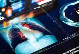 زنگ خطر برای یک فاجعه قریب‌الوقوع | لنست از آمار هولناک خبر داد؛ احتمال مرگ  ۱۸.۶ میلیون نفر در سال