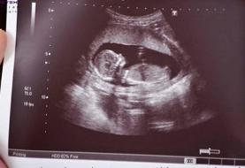 پیشگیری روی کاغذ، معلولیت در واقعیت/ بهزیستی با غربالگری‌های «۳۰ ساله»، قادر به پیشگیری از بروز ...