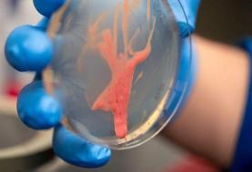 کشف راز یک قاتل نامرئی/ این باکتری گیاهان را از پا درمی‌آورد