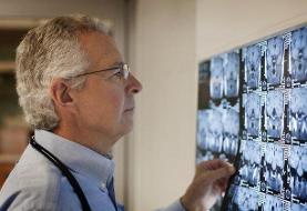 سکته هشداردهنده چیست؟؛ در صورت داشتن این علائم فوراً به اورژانس زنگ بزنید!