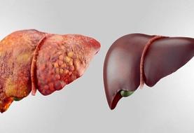 ۶ راهکار مهم برای پاکسازی کبد | مواد غذایی مؤثر در پاکسازی کبد را بشناسید
