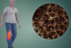 کدام خوراکی‌ها برای سلامت استخوان‌ها خطرناکند؟