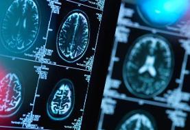 هشدار به بیماران صرعی و آسمی درباره قطع دارو در ایام روزه‌داری