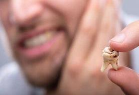 پنج اشتباه رایج در مراقبت از دندان‌ها