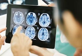 چه کسانی بیشتر در معرض خطر تومورهای مغزی هستند؟