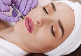 هشدار درباره فیلرهای نامعتبر / مجوز هر فیلر فقط برای همان ناحیه است / خطر نابینایی و آسیب بافتی